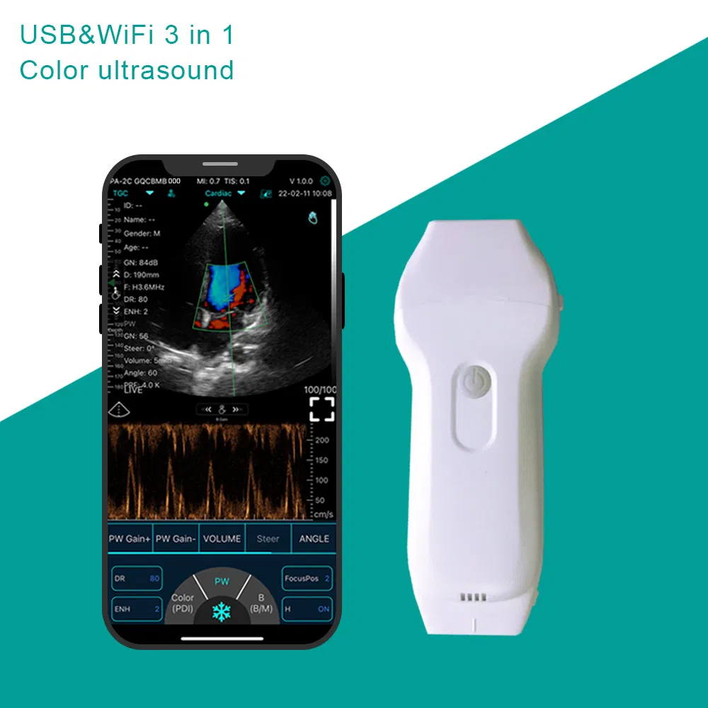 Wireless Ultrasound Probe for Convenient Patient Monitoring Solutions C10XL