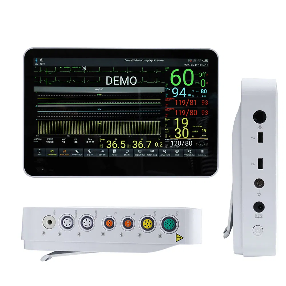WiFi Contec China Hospital ICU Android Smart Tablet Monitor Remote Patient Monitoring
