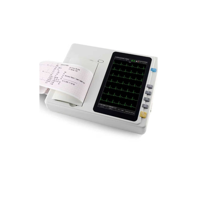 Advanced Compact ECG Machine with 6-Lead Monitoring Features