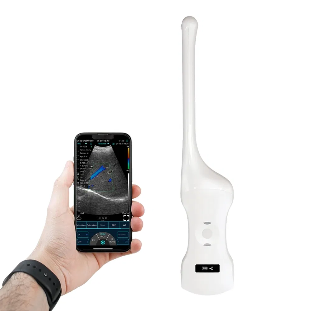 Smart Rechargeable Dual-Mode Ultrasound Handheld Probe for Cardiac and Transvaginal Assessment