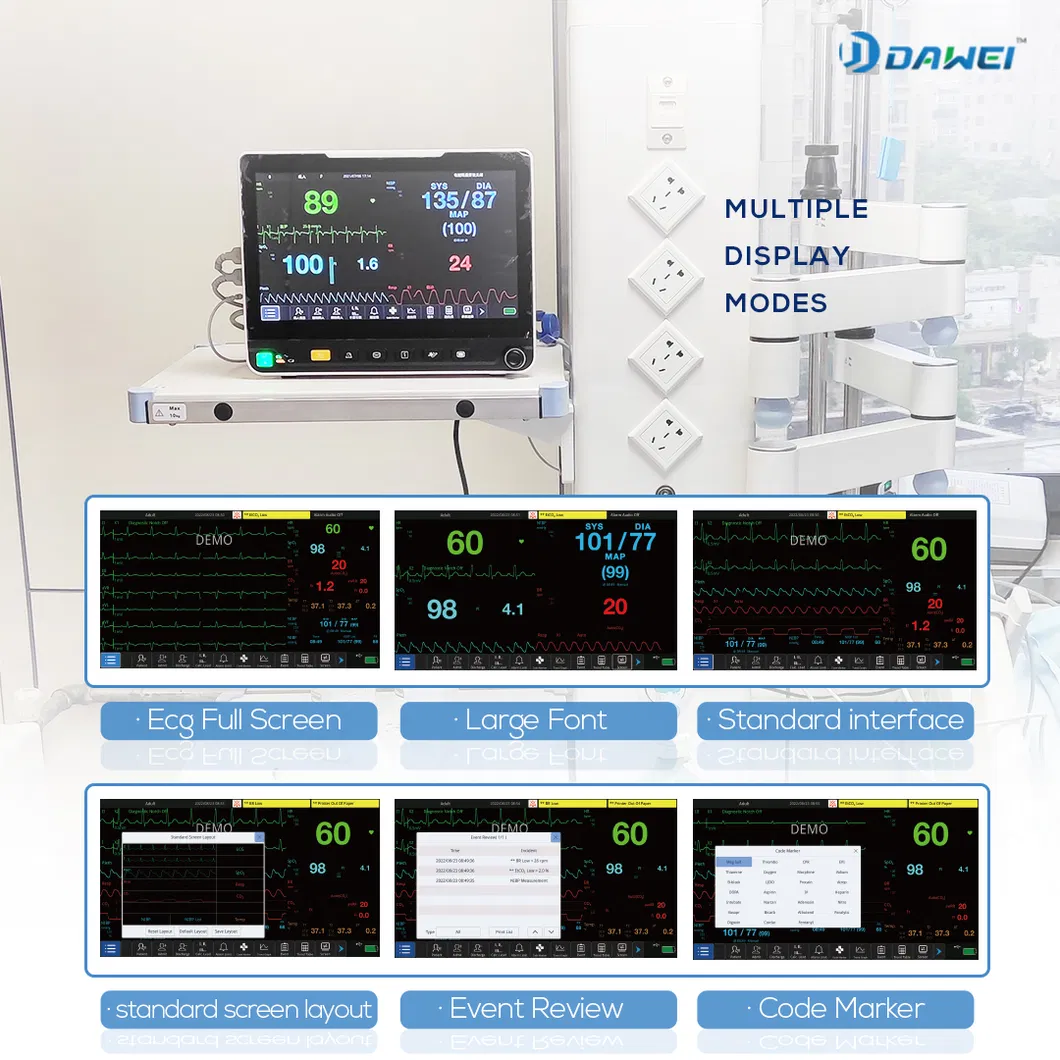 Patient Monitor View 2