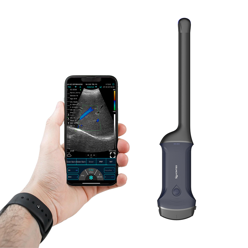 KONTED C10RQpro Handheld Wireless Ultrasound Scanner - High Quality, 3-in-1 (Cardiac/Convex/Transvaginal), Cavity &amp; Convex Probes Included, Easy to Carry