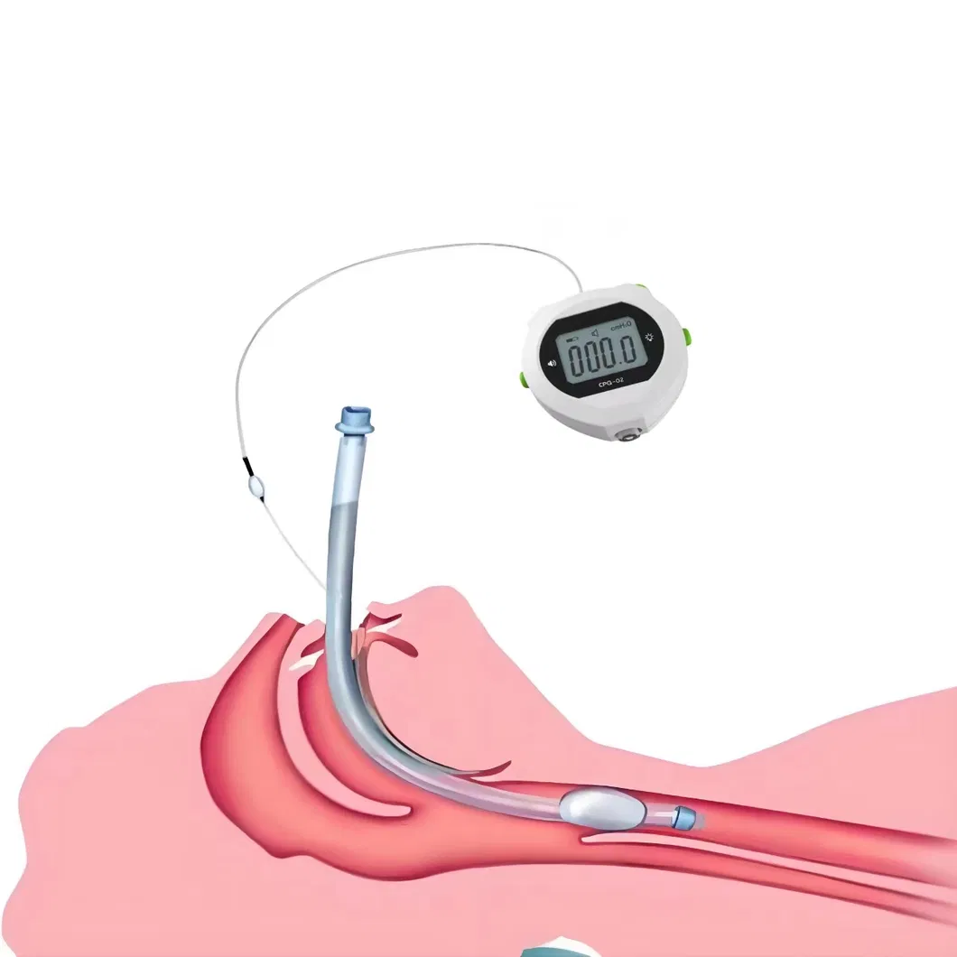Cuff Pressure Monitor Features