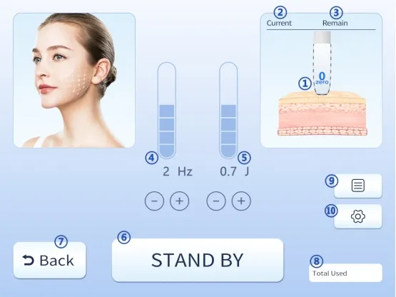 Component View