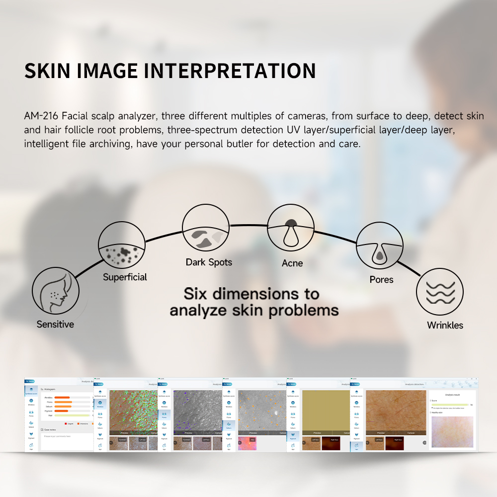 15.6 Inch LCD Scalp Detector Hair Skin Analyzer Microscope for Hair Follicle Testing and Skin Analysis Magnifier 50/100/200X