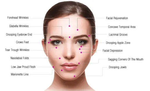 HIFU Treatment Areas