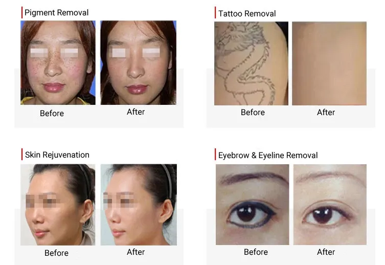 Treatment Results