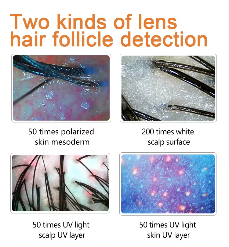 50X 200X Digital Hair Microscope Scalp Analyzer with AI 4 Grid Comparison Scalp Analyzer Hair Follicle Detector