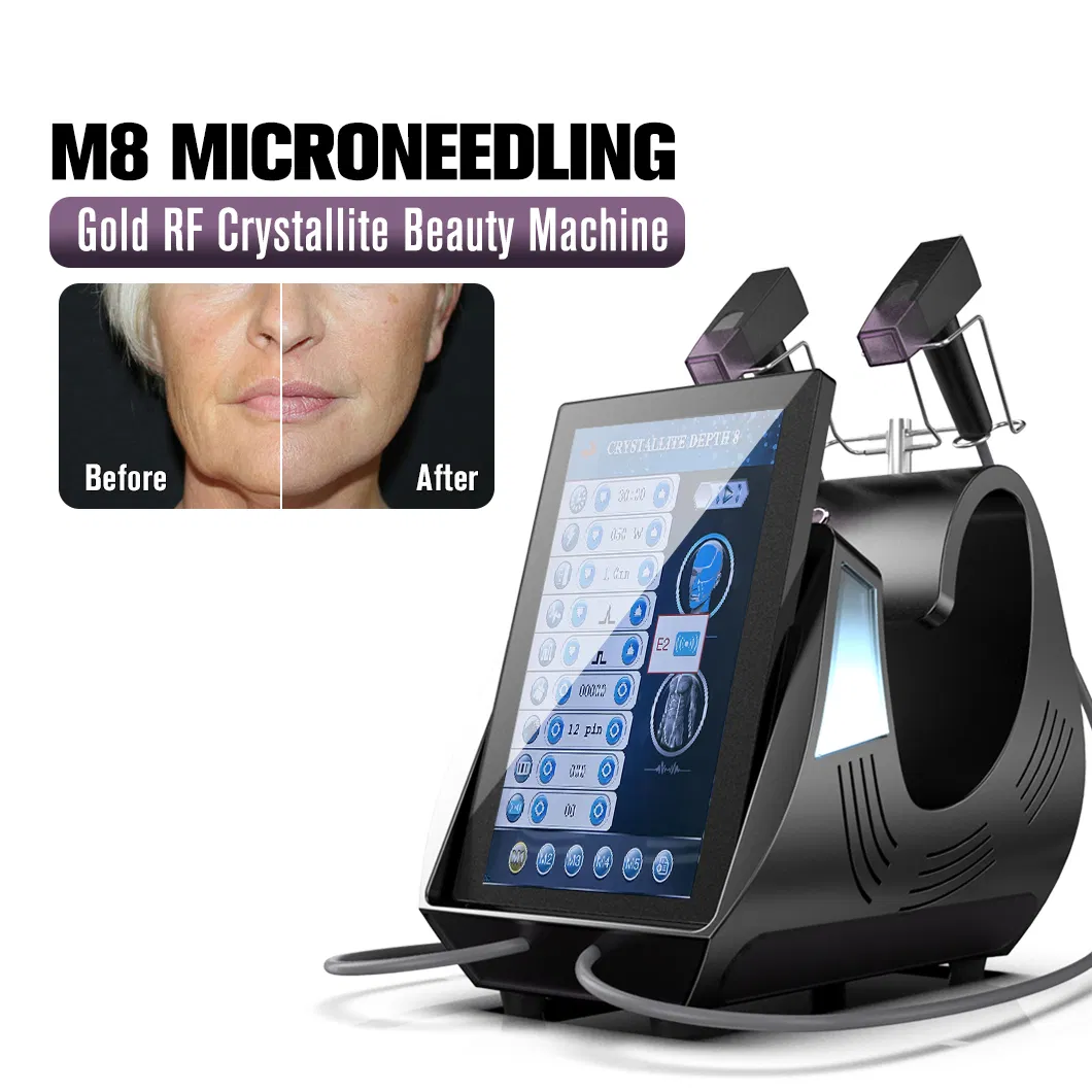 RF Microneedling Skin Tightening