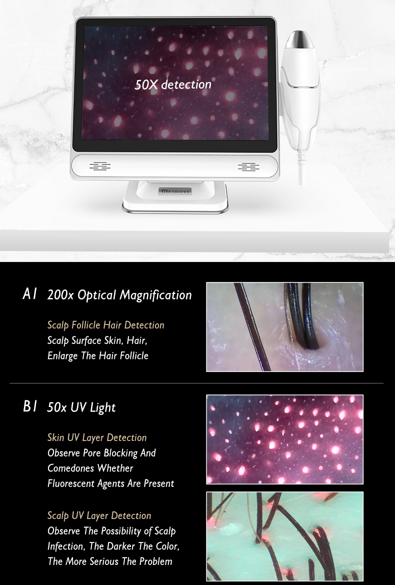 Meiboyi 10.1 Inch Small Professional Scalp Detector HD Home Use Hair Analysis Machine Hair Follicles Scanner Beauty Salon Device