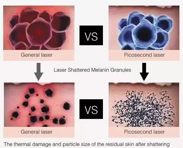 Laser Theory