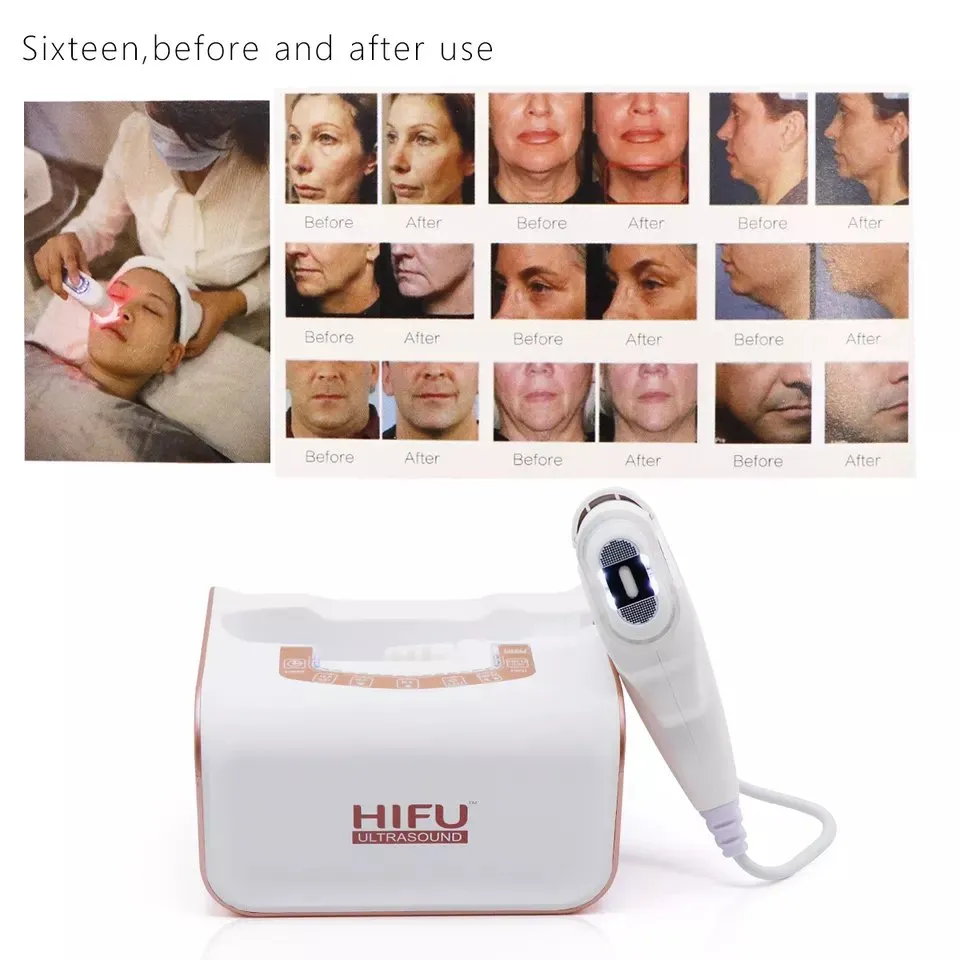 Main Product View