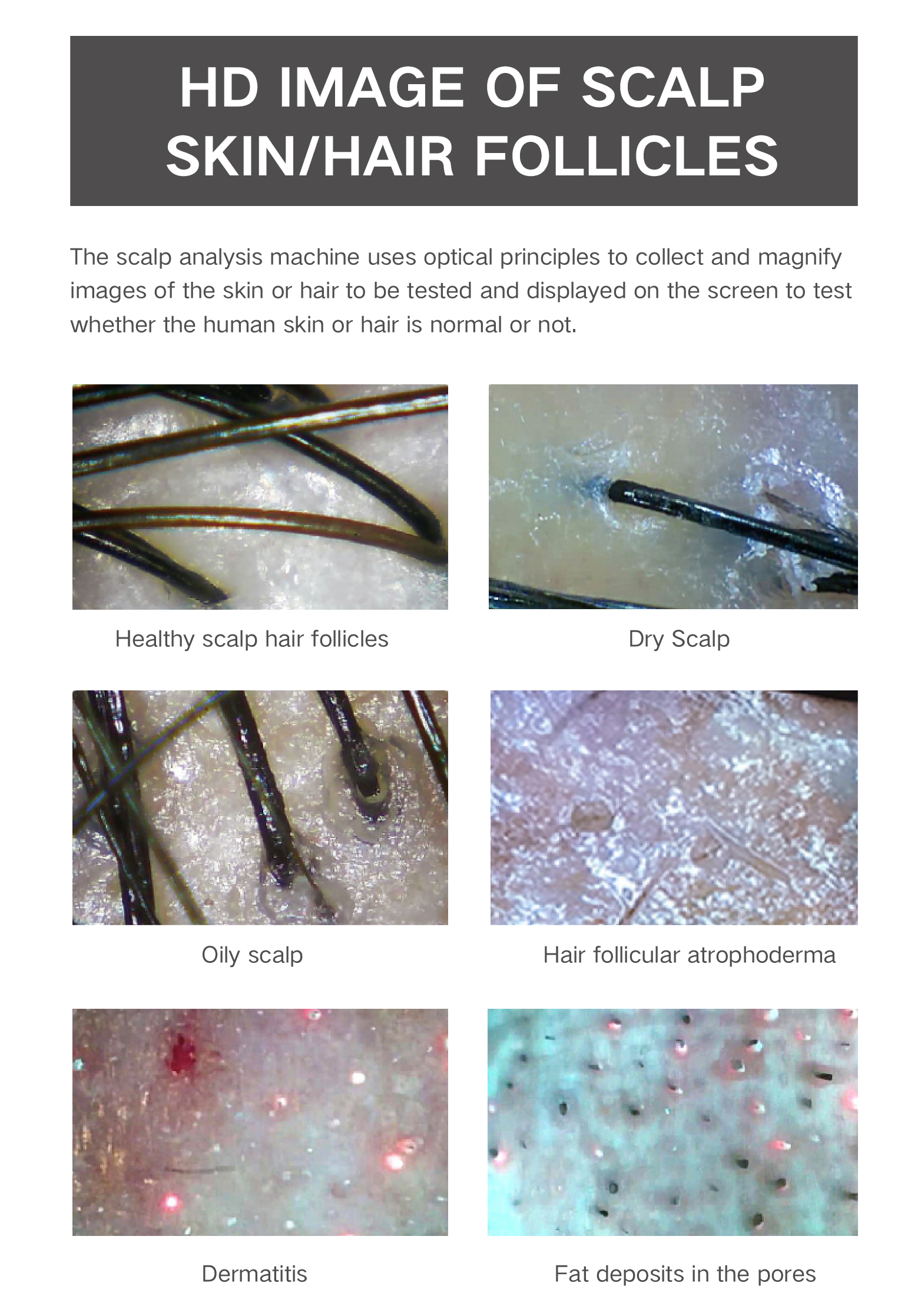 HD Digital Microscope Hair Follicle Detector Scalp Diagnostic Machine 11 Inch LCD Skin Analysis Scanner