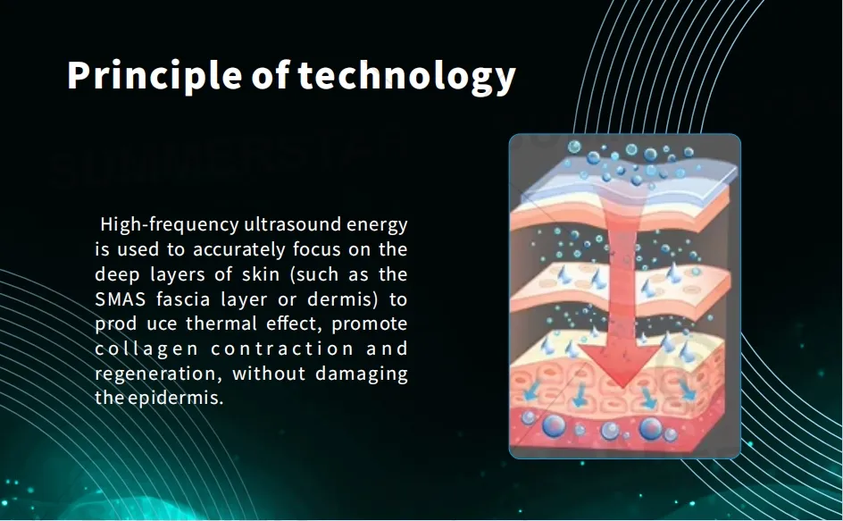 Ultrasound Treatment