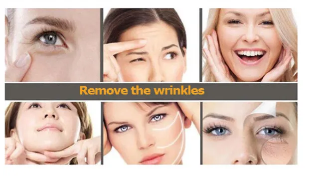 RF Application Effect