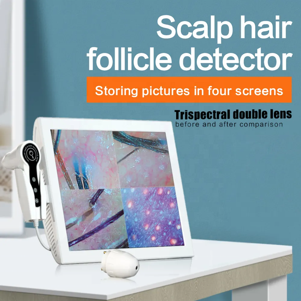 Scalp zoom analysis