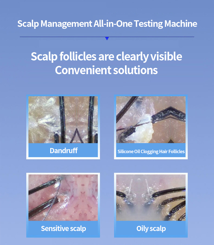 Professional 5-in-1 Multi-functional ABS Portable Desktop Hair Scalp Analyzer Tricoscope Digital Microscope Machine SPA/Salon