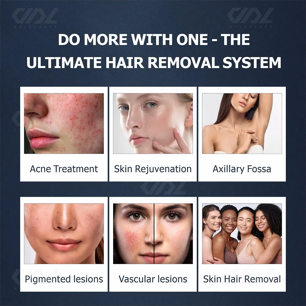 Factory Wholesale IPL Opt Hair Removal Device Skin Rejuvenation Whitening Beauty Machine Hair Removal Device for Salon Use
