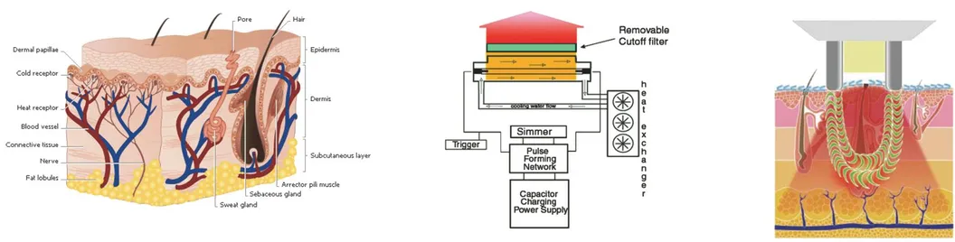 IPL Technology
