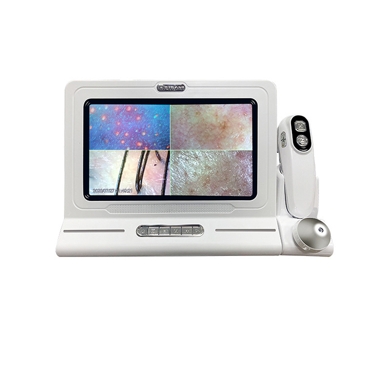 HD Digital Microscope Hair Follicle Detector Scalp Diagnostic Machine 11 Inch LCD Skin Analysis Scanner