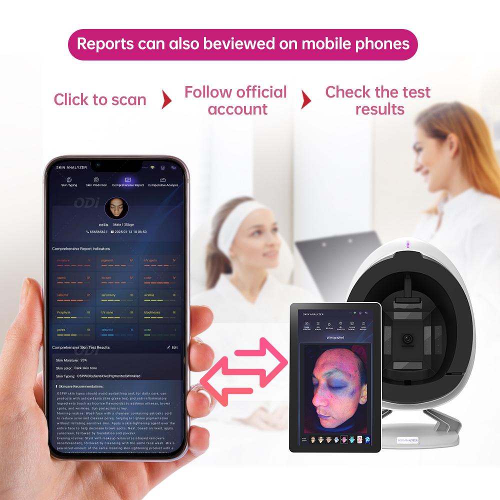 Skin Analyzer Image 4