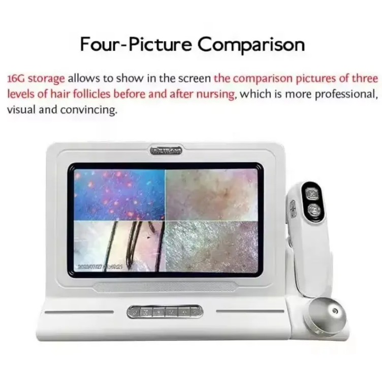 Newest Smart Hair Scalp Microscope Wifi Skin and Hair Analyzer Testing Machine for Skin Care US/It/ZA Plug Type