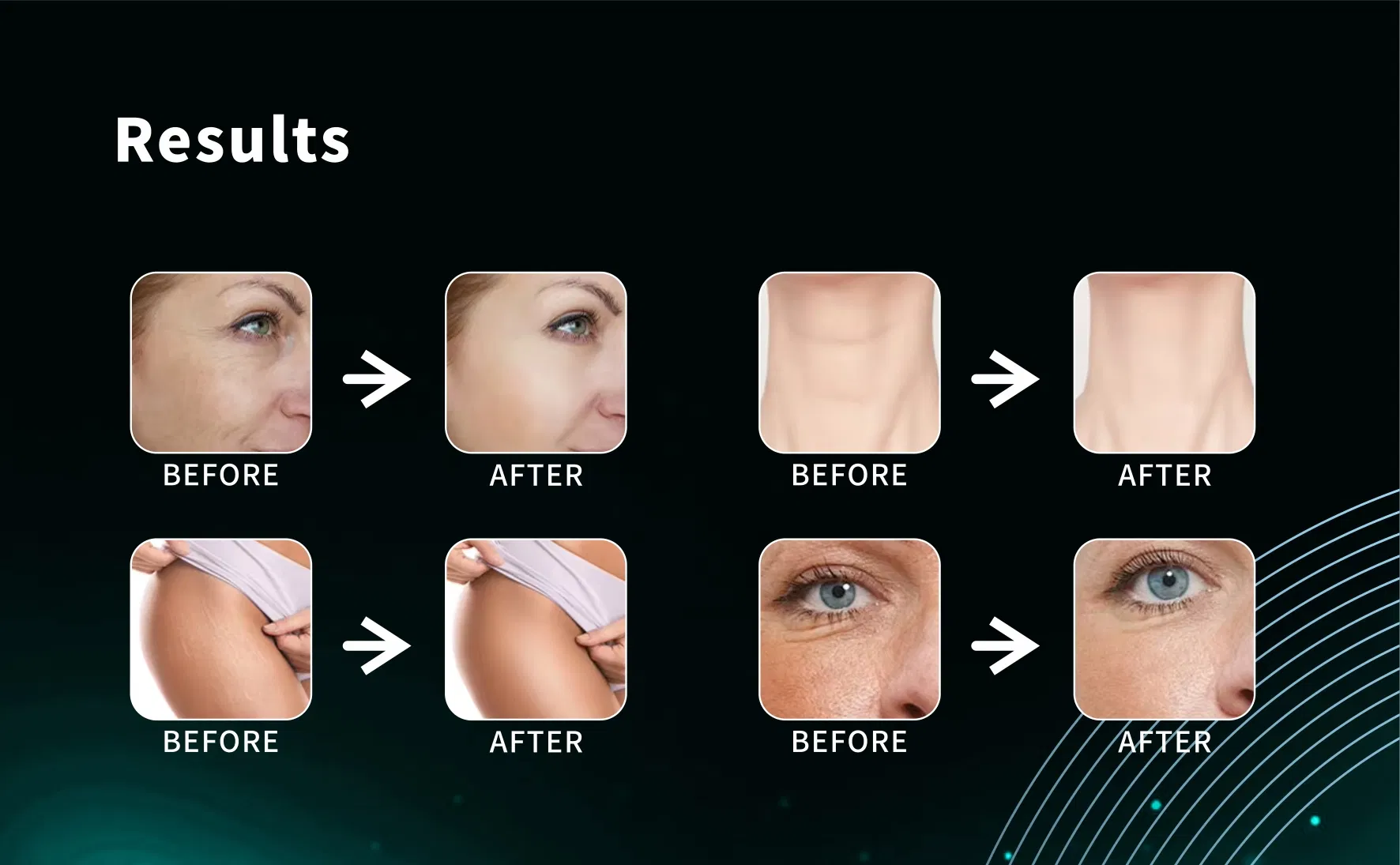 Skin Care Equipment