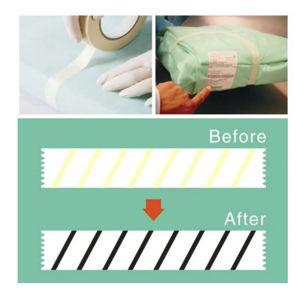 Sterilization Packaging