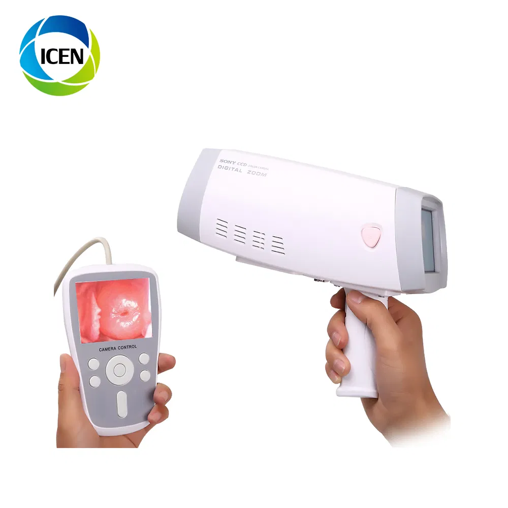 IN-G9800B &nbsp;Mini Handheld LED Light Full HD Vagina Camera Colposcope