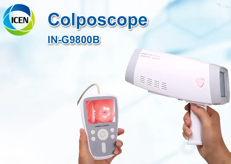 Full HD Vagina Camera Colposcope