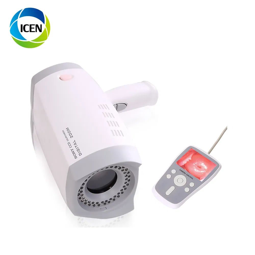 IN-G9800B &nbsp;Mini Handheld LED Light Full HD Vagina Camera Colposcope