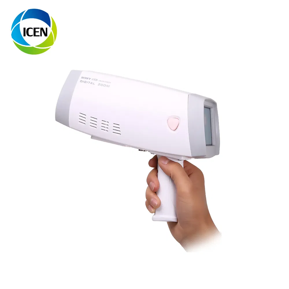 IN-G9800B &nbsp;Mini Handheld LED Light Full HD Vagina Camera Colposcope