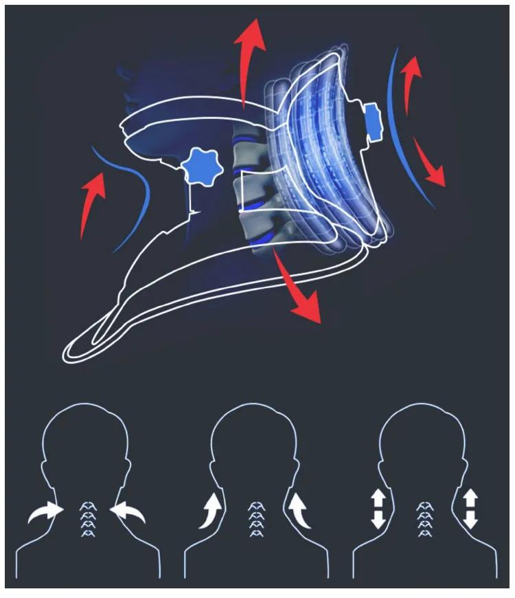 Inflated Collar Neck Air Traction Device for Cervical Spondylosis