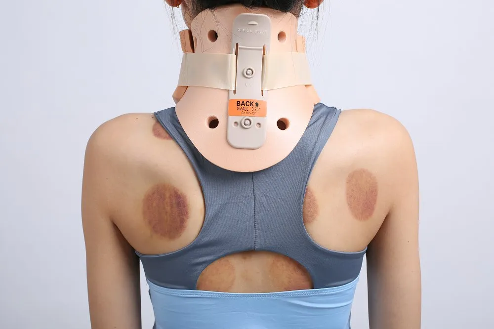 Cervical Collar Photo 9