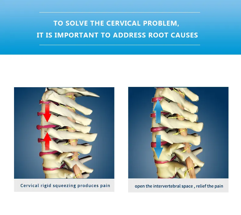 Cervical Traction Device 4
