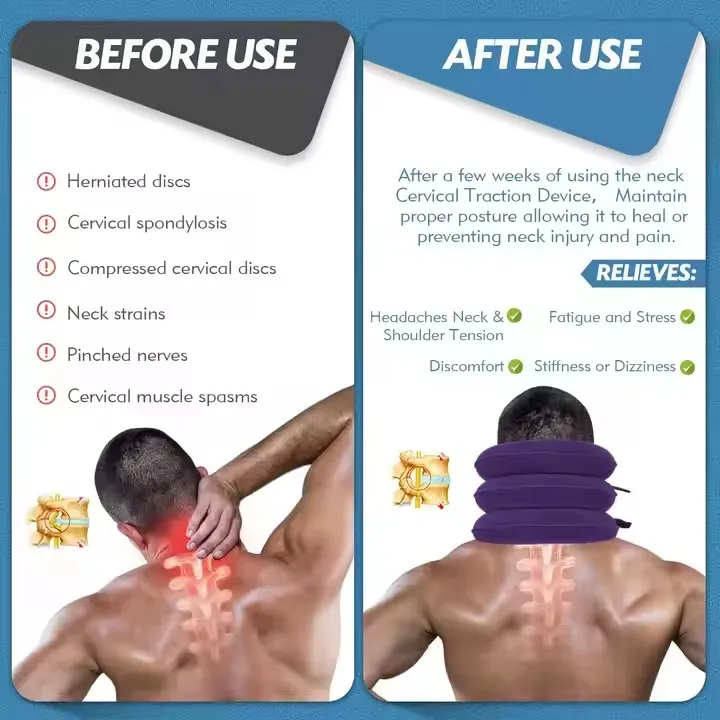 Neck Traction Device 2