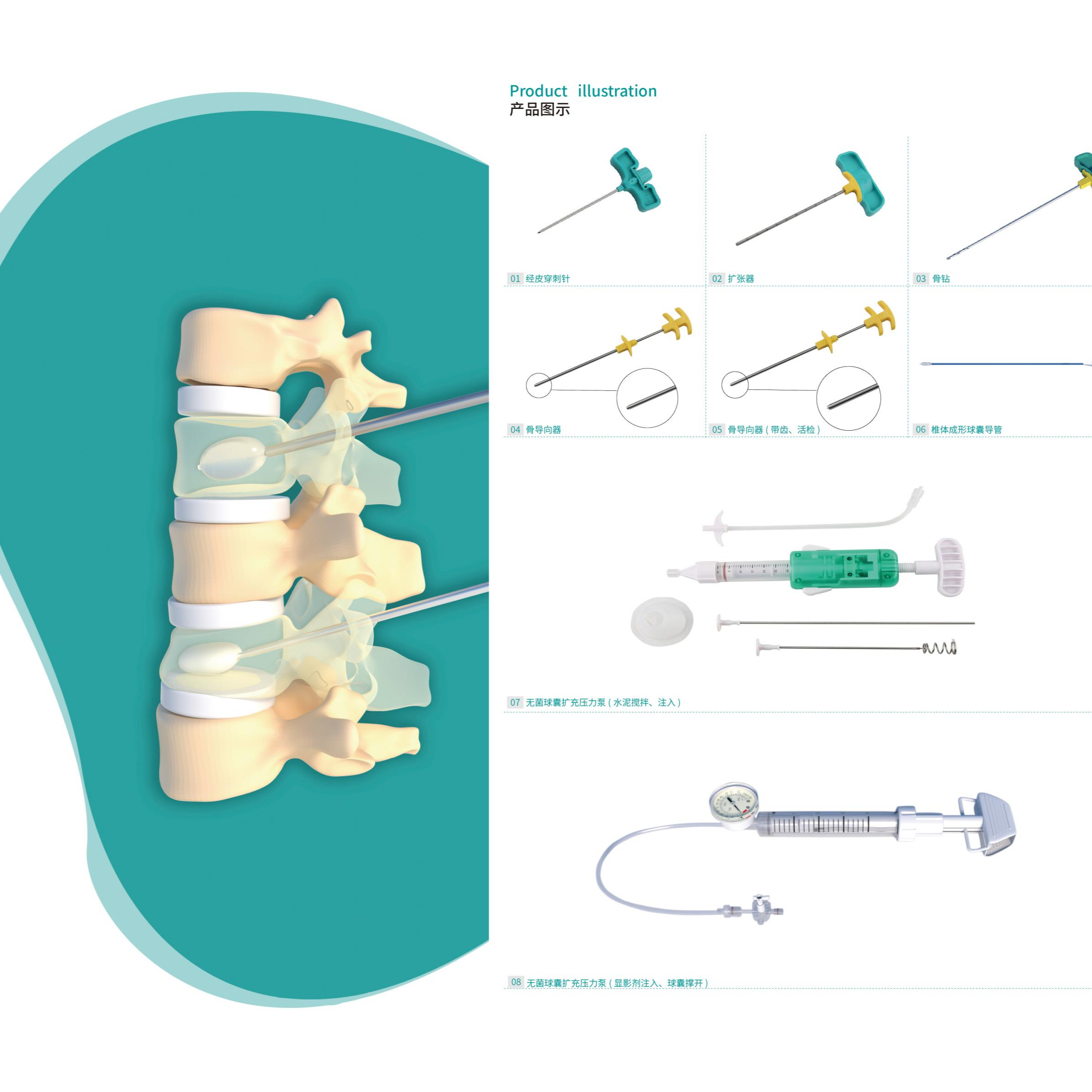 FULE PKP Working Channel Vertebral Body Instruments-Orthopedic Surgery Class I Model 13400003