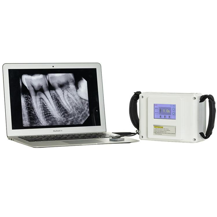 Dental Equipment Digital Portable Dental X Ray Unit and Hdr 500 Digital Dental Sensor Set