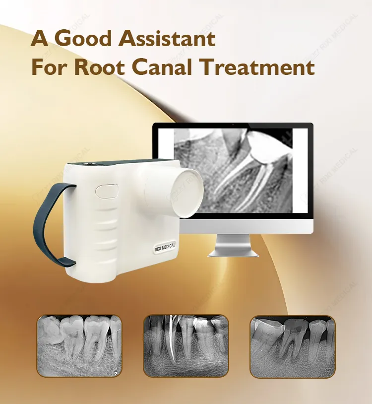 Root Canal Assistant
