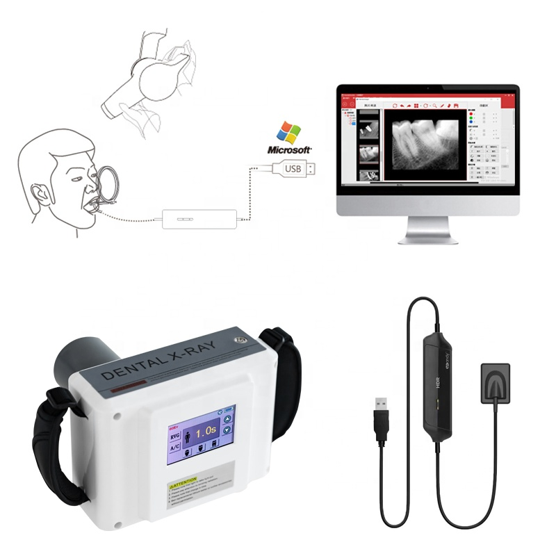 Dental Equipment Digital Portable Dental X Ray Unit and Hdr 500 Digital Dental Sensor Set