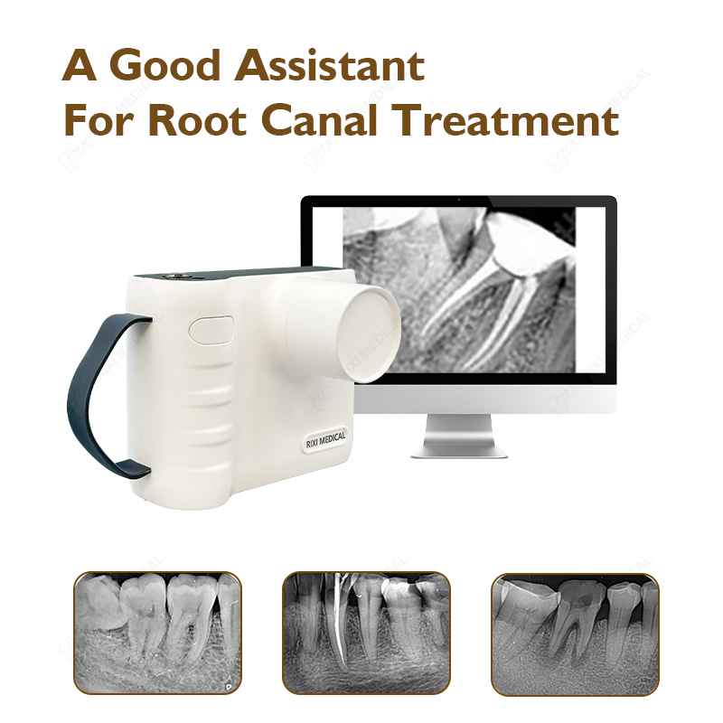 Hot Sale Rixi ISO China Ultrasound Portable Transducer Scanner Unit Dental Xray