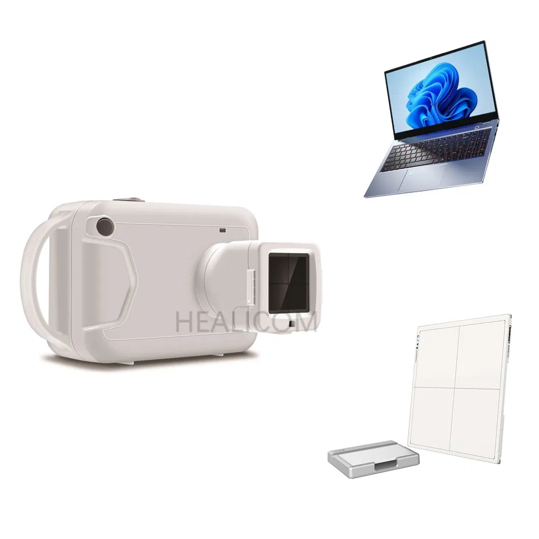 High Quality Dental Medical Portable Hand Held Digital X Ray System