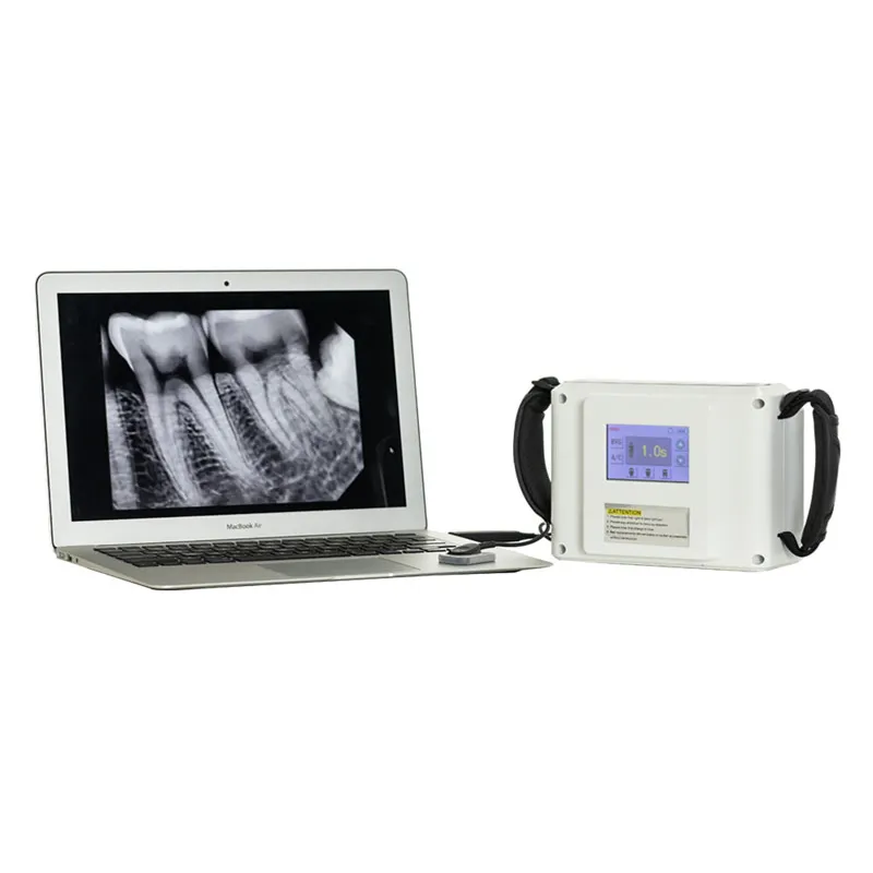 X-Ray Device Feature