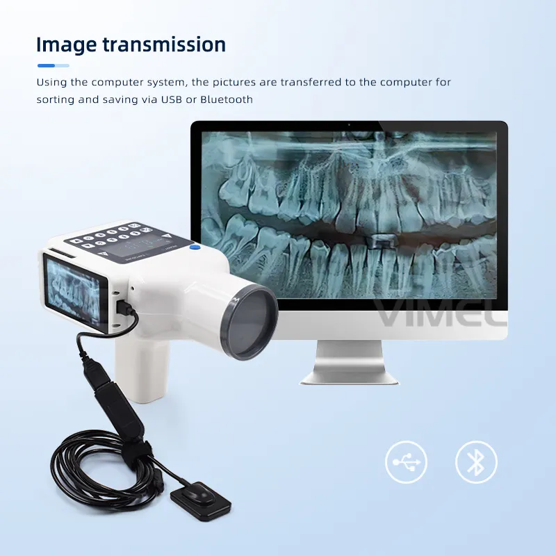 Dental Portable X Ray 6