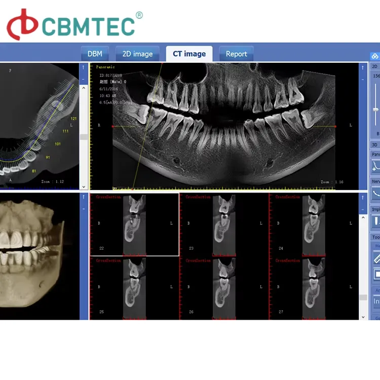 Digital Panoramic Dental X-ray System 2