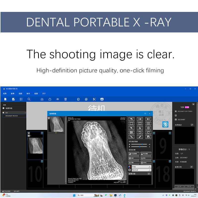 Wireless Portable Dental X-ray Mcachine Hand Held High Frequency LCD Display Touch Screen Radiography Intraoral Xray Unit 60kv 2mA