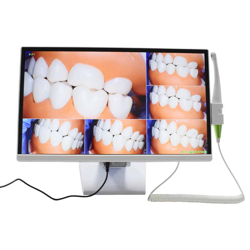 Dental Computer Integrated Endoscope HD Camera Ai Image System