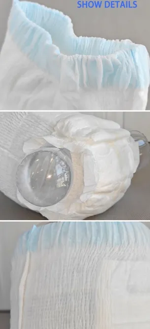 Capacidad de absorción