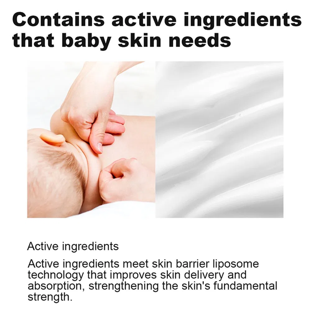 Crema para la dermatitis del pañal para bebés, fórmula natural y suave que calma la piel irritada del bebé