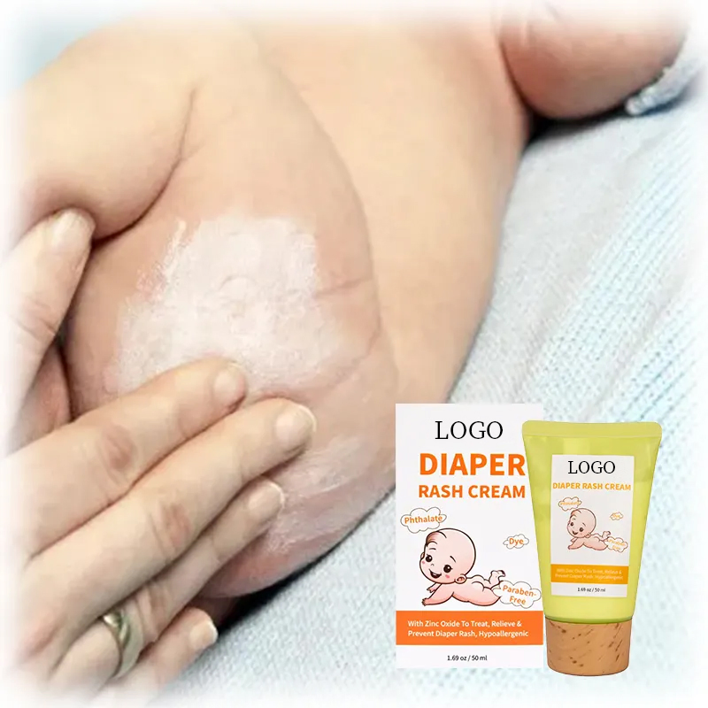 Crema para la dermatitis del pañal para bebés, al por mayor, que alivia y previene la dermatitis del pañal